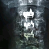 ACDF Employee John F.'s profile photo