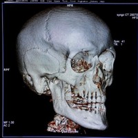 Department of Medical Imaging, University of Toronto Employee Gary Cronin's profile photo