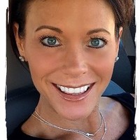 Bausch + Lomb Employee Chandra Thompson's profile photo