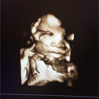 HIGH PLAINS RADIOLOGICAL ASSOCIATION, L.L.P. Employee April Bailey's profile photo