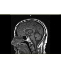 CastleRock REO Employee Ted Weinstein's profile photo